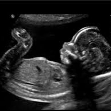 Moment In Time Imaging 3D Ultrasound Beaumont Texas